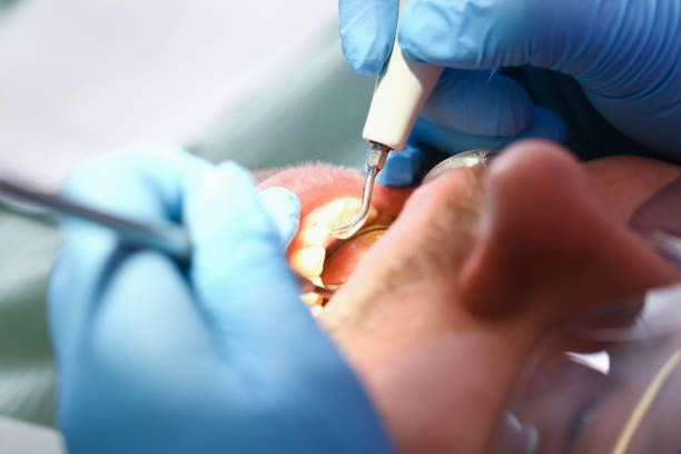 Best Emergency Dental Surgery in Whiteville, NC