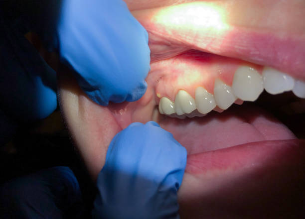 Best After-Hours Emergency Dentist in Whiteville, NC